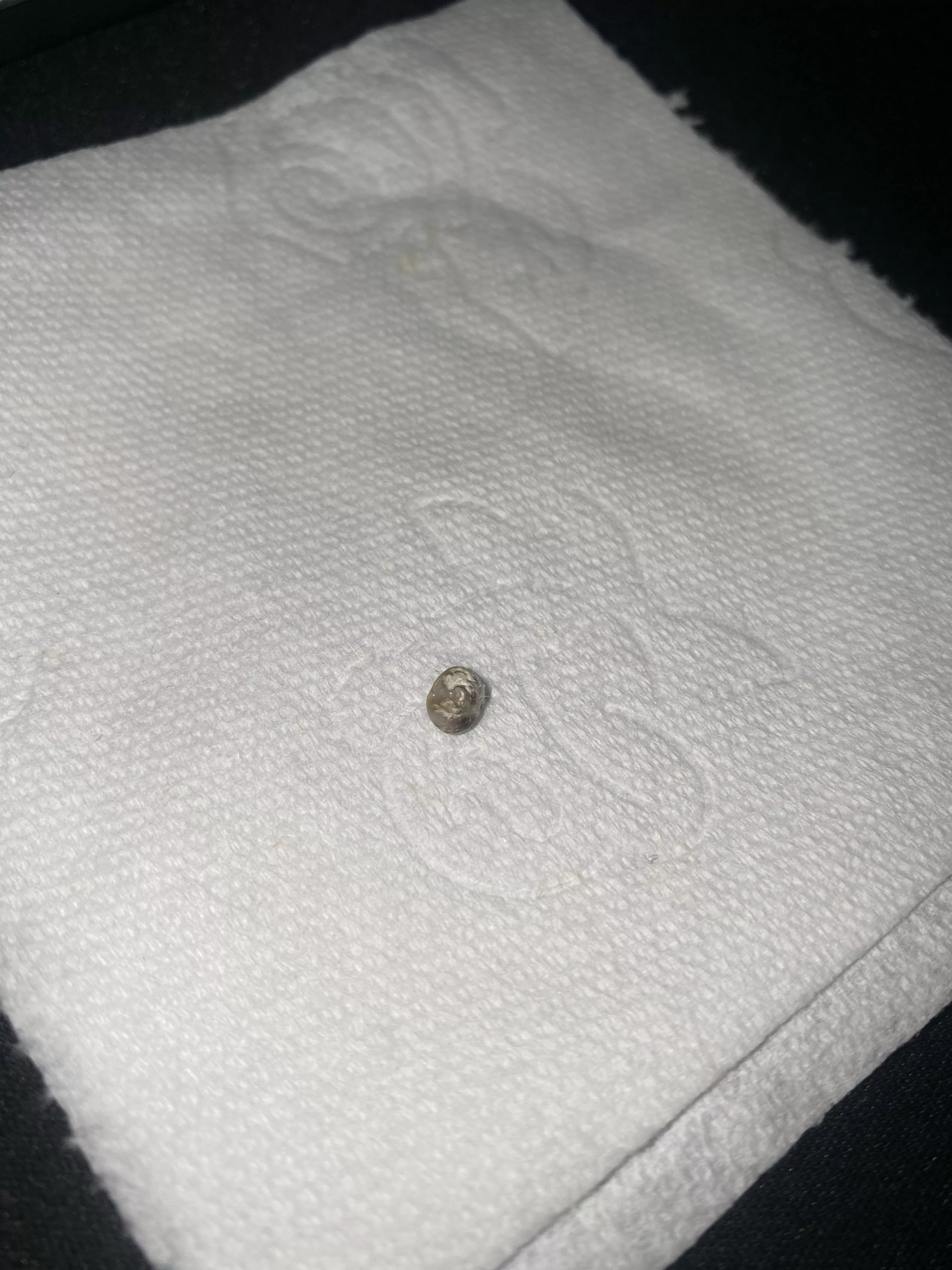 Any idea what this is? Came out of my back.