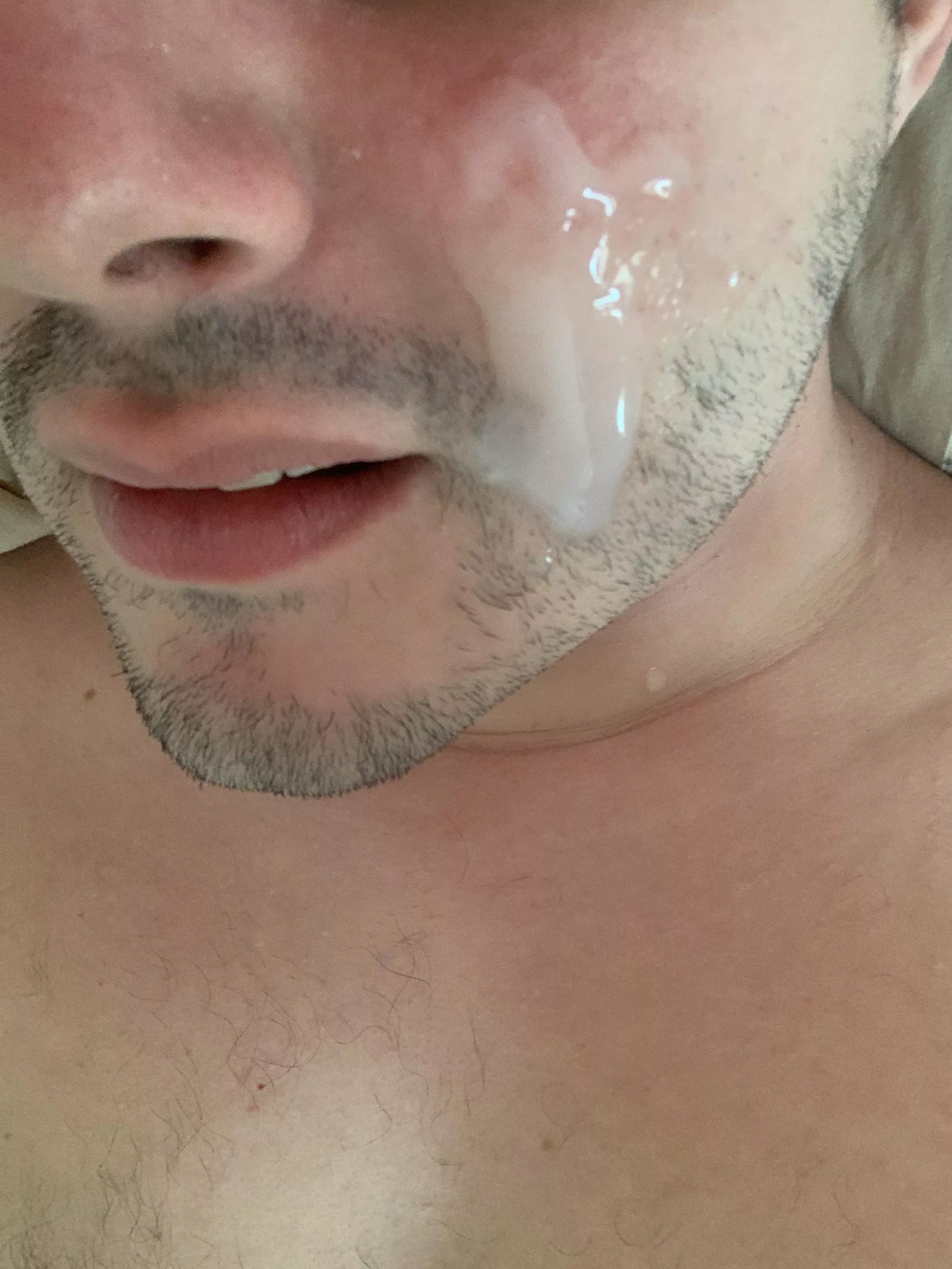Cheek deposit