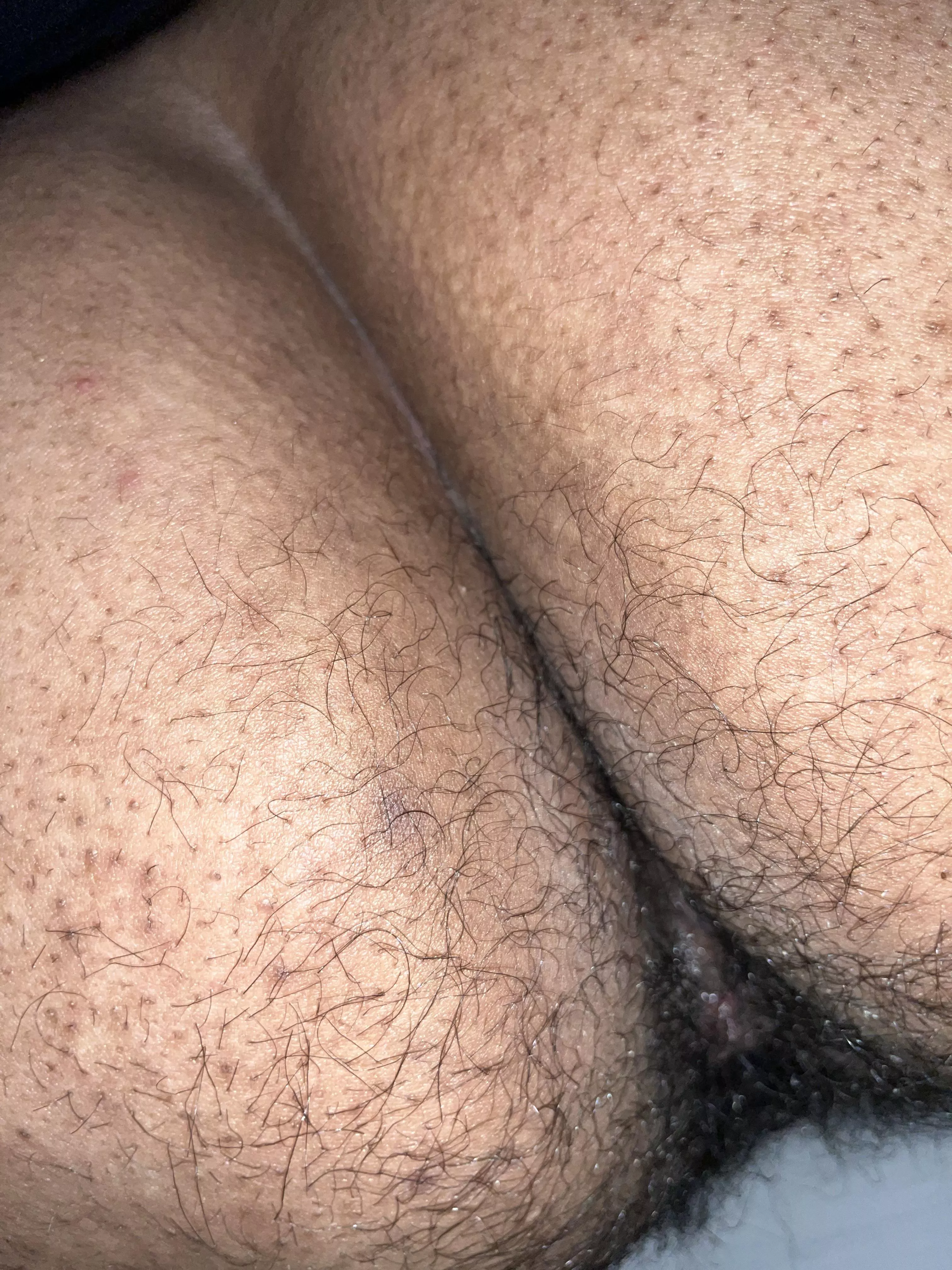 Hairy butt