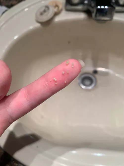 I’m aware that these aren’t as big as most of the ones found on here (because I have a habit of popping my stones like every 2 days) but I popped a good amount out today