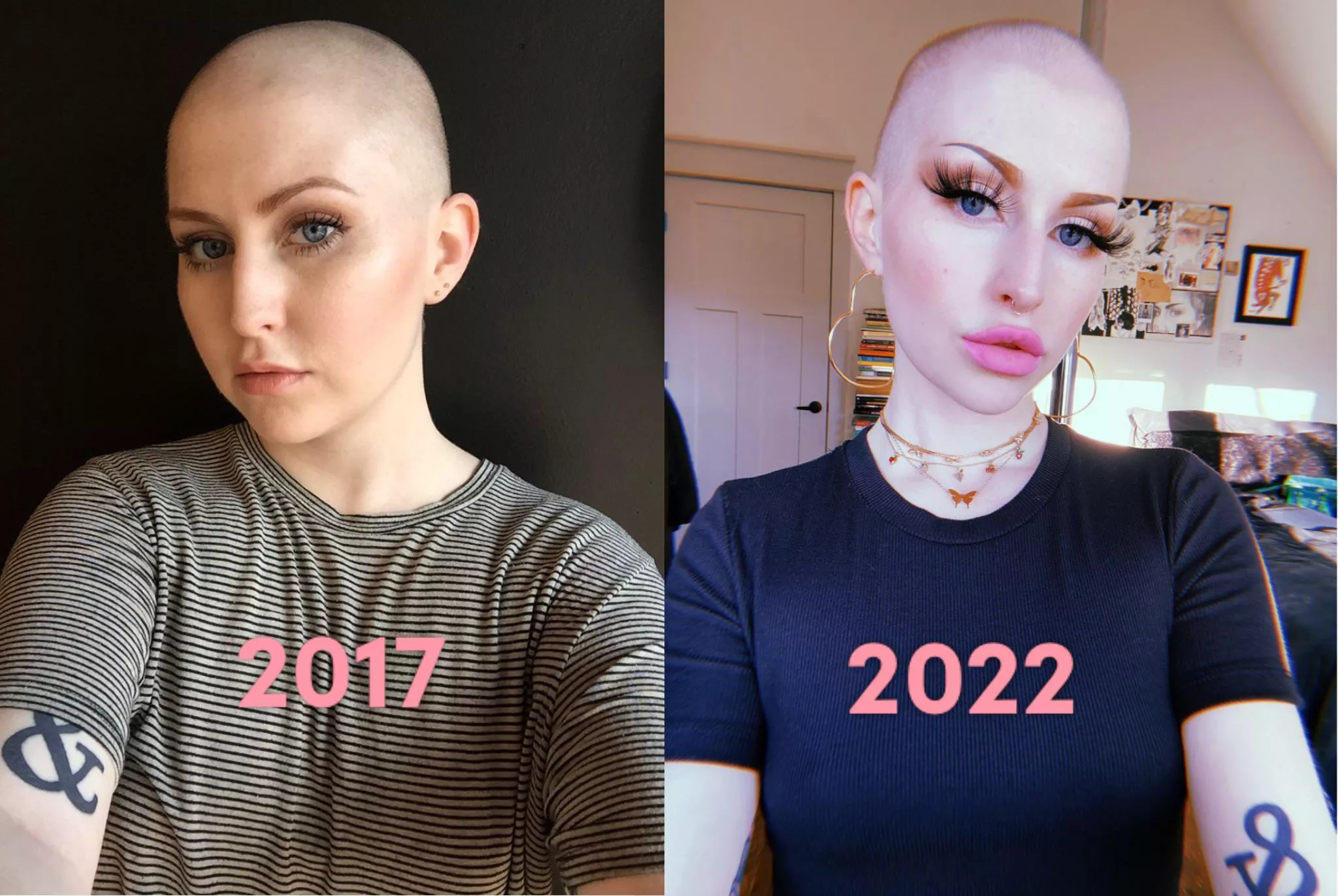 progress 💖 need big lips and tits next, don’t you agree?