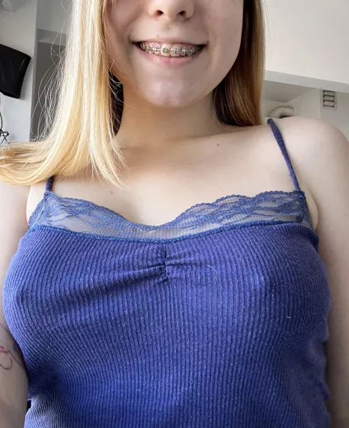 Braless and braces!