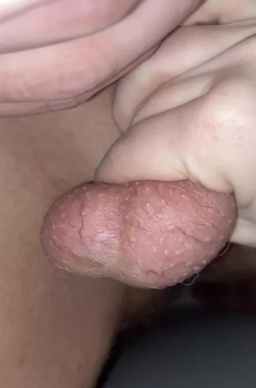 His young balls are nice and red, what should i do next?