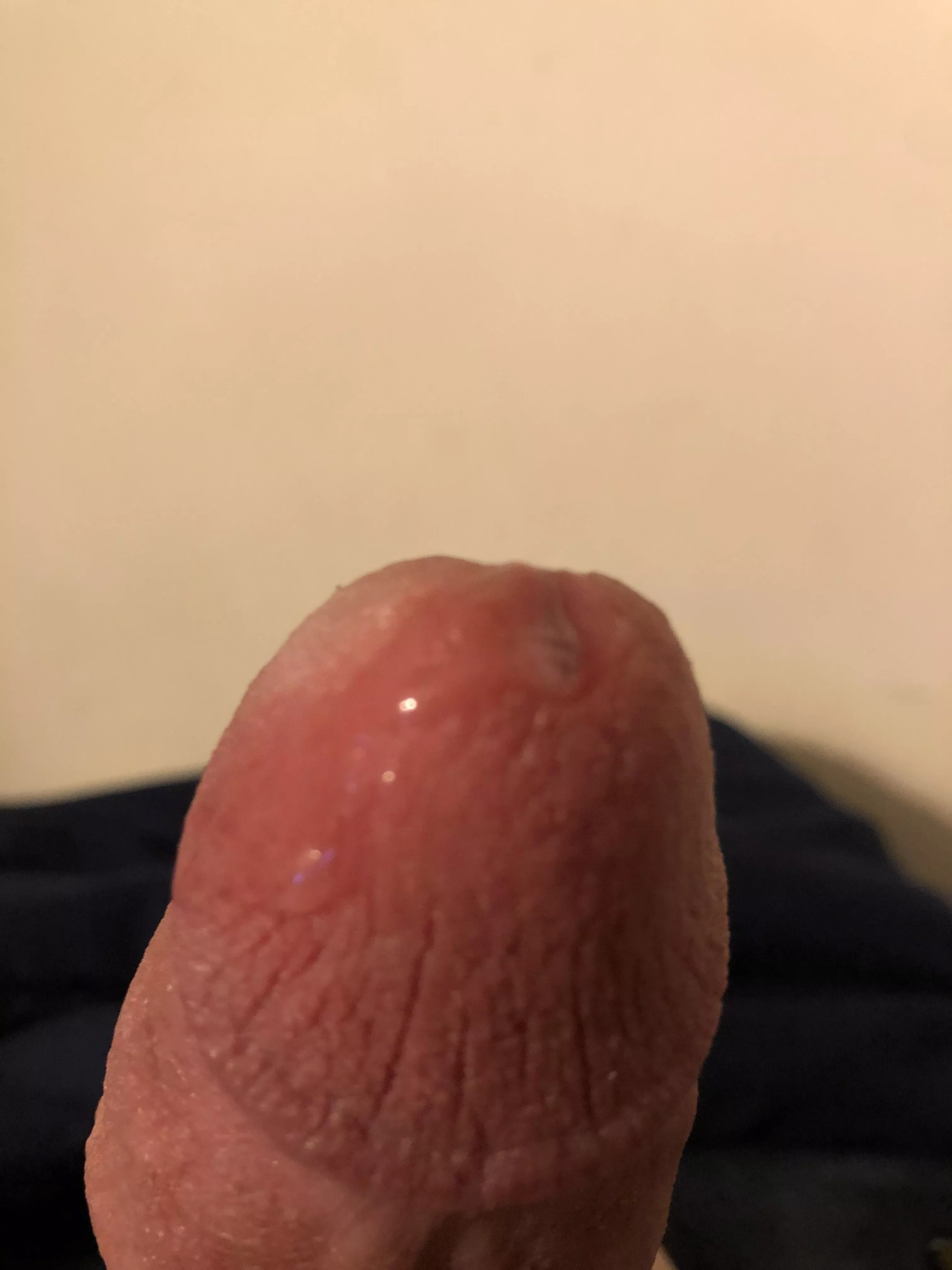 Does anyone like?