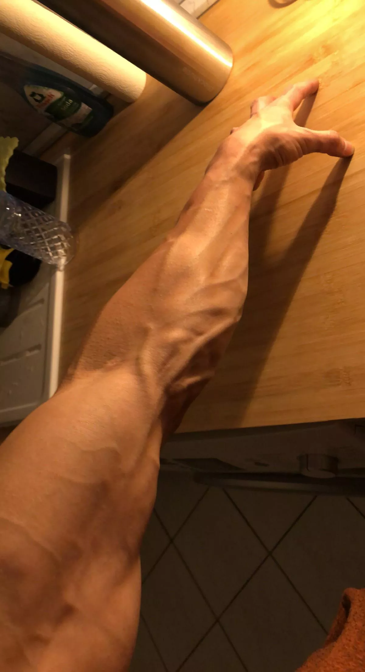 7 PM forearm