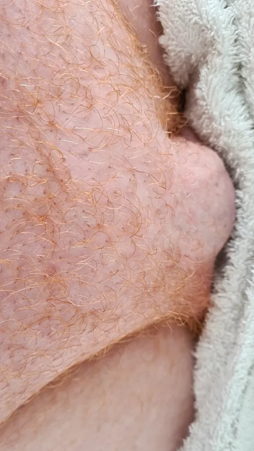 6 weeks after shaving it all completely off its now growing back well.