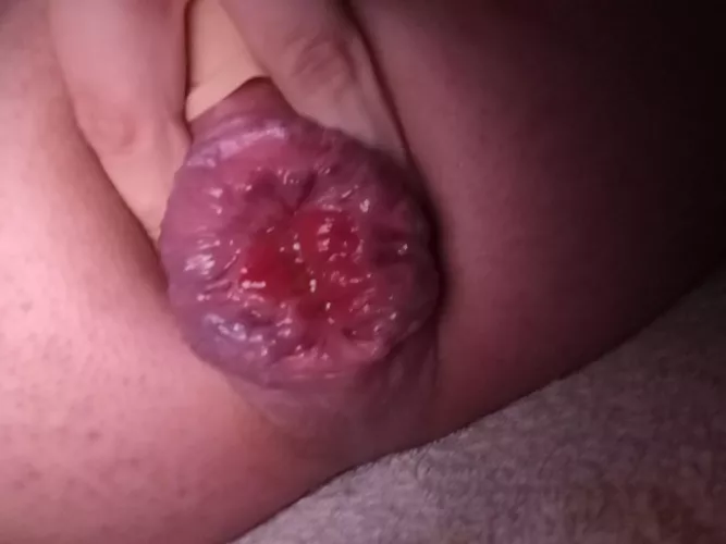 He taped my pussy shut and fucked me in the ass