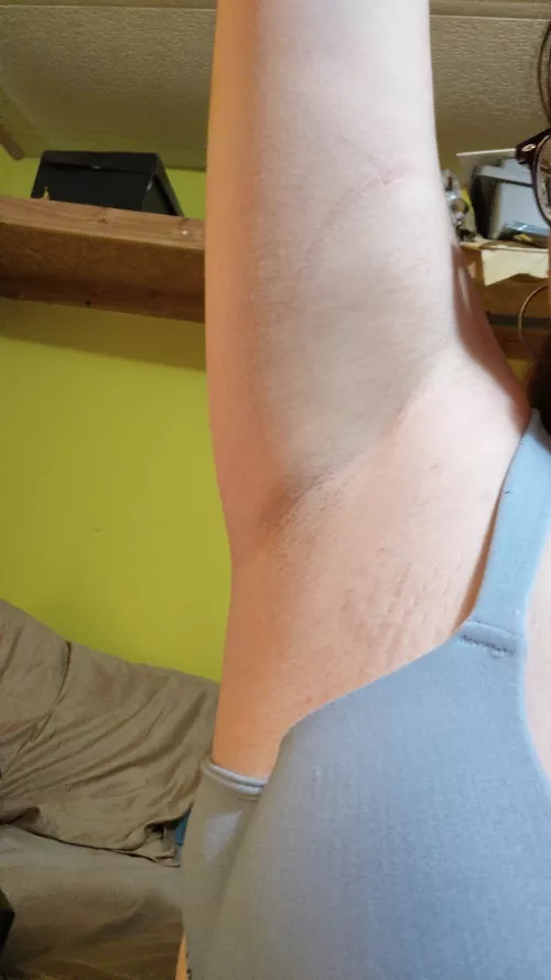 don't mind the stretch marks 😖