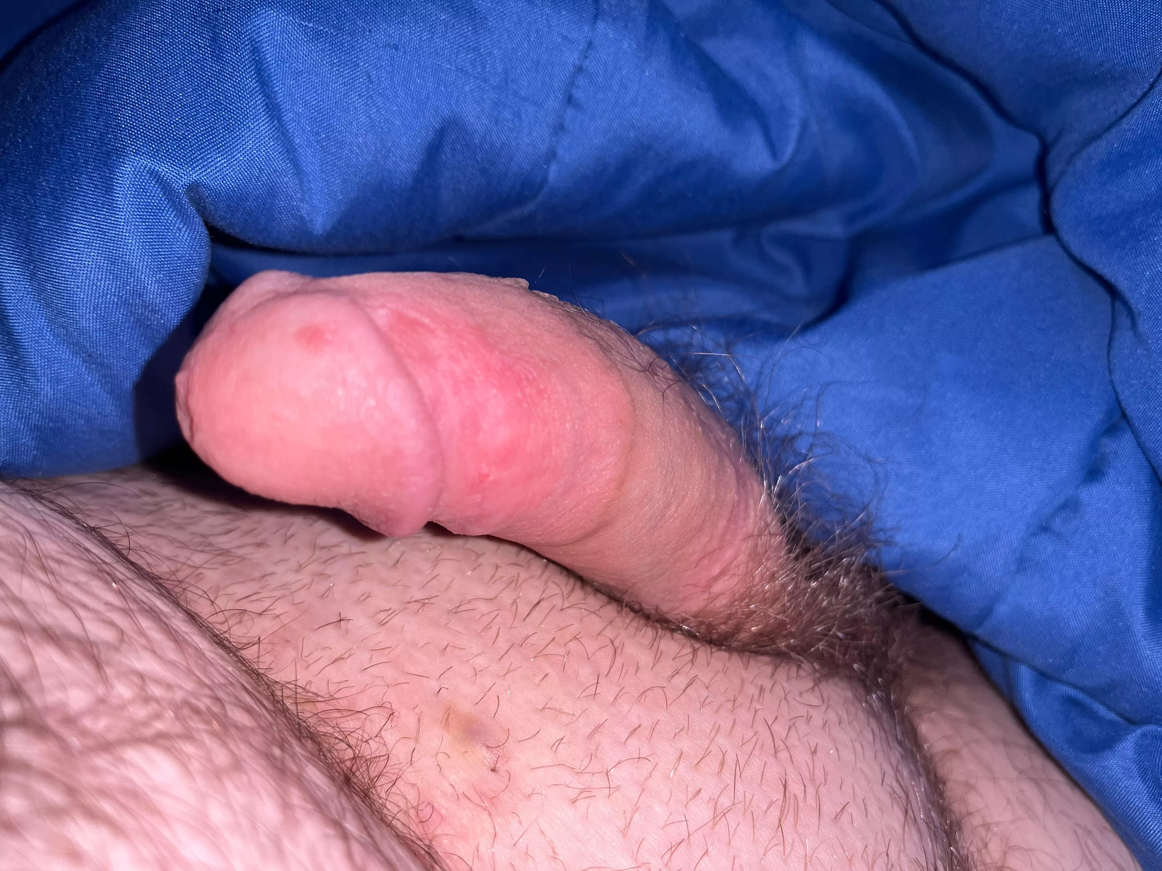 Hmu