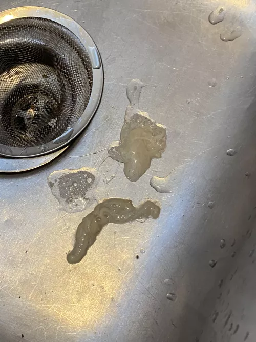 Largest snot I have ever seen from my 7 year old. Sorry this is a photo and not a video! I have no idea what this is, regular snot? Sinus infection? Pieces of his brain?