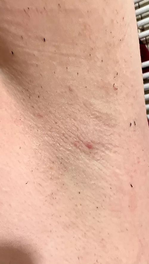 Wet, dirty and smelly