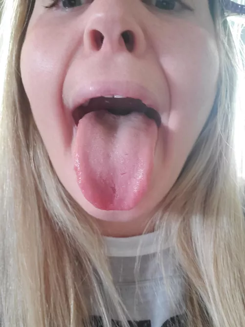 Finish the sentence: That tongue looks like it needs _________