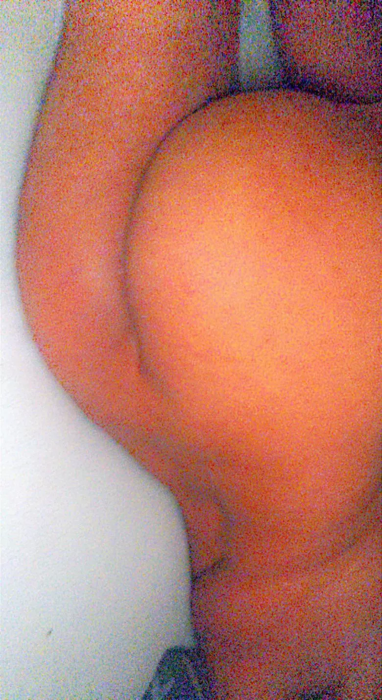 🙈