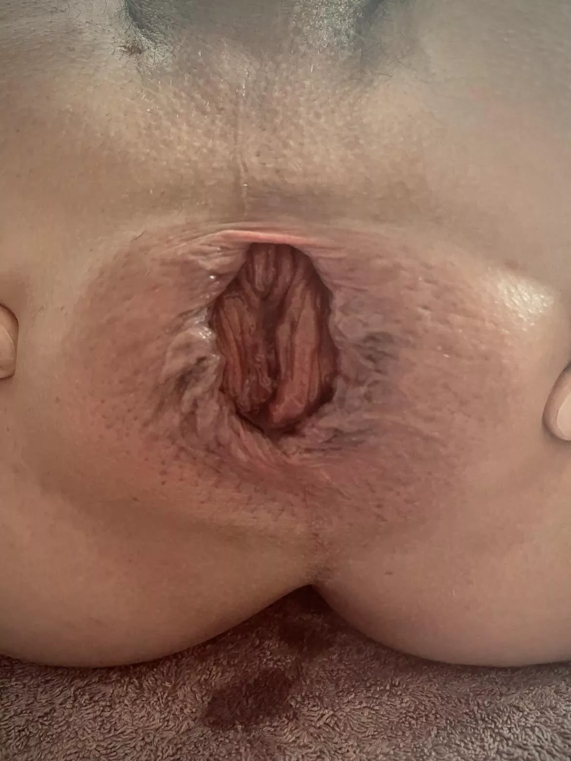 …