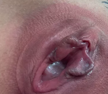 💋💋