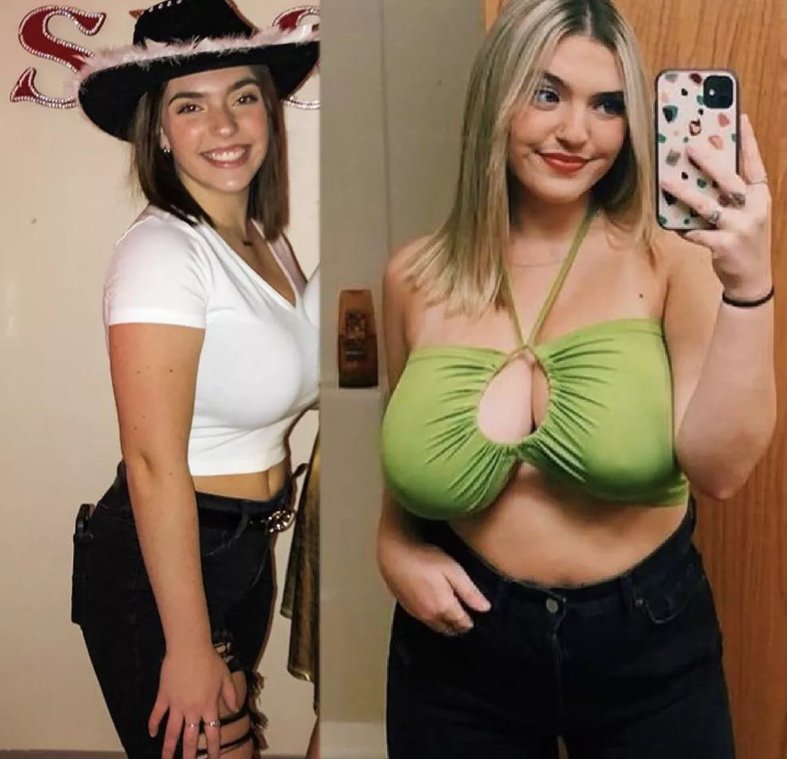 11 month breast growth 11 month breast growth