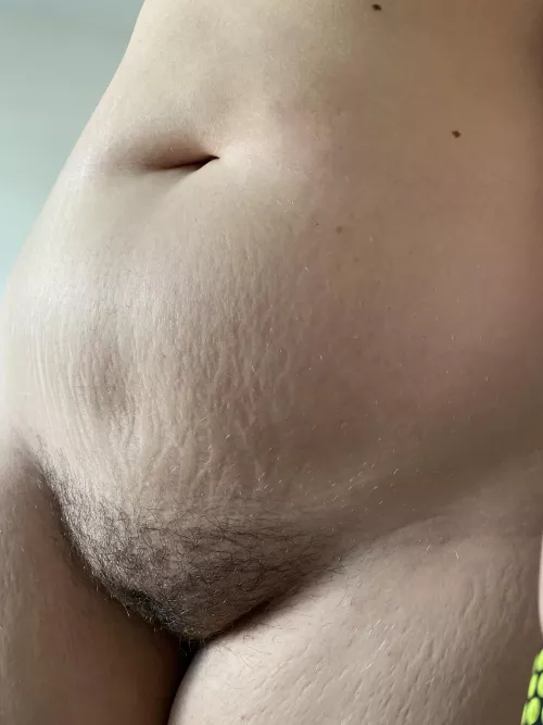 A unfiltered lower stomach after 70lbs weight loss since last year around this time. F21 5’11” SW:275 Today:205ish