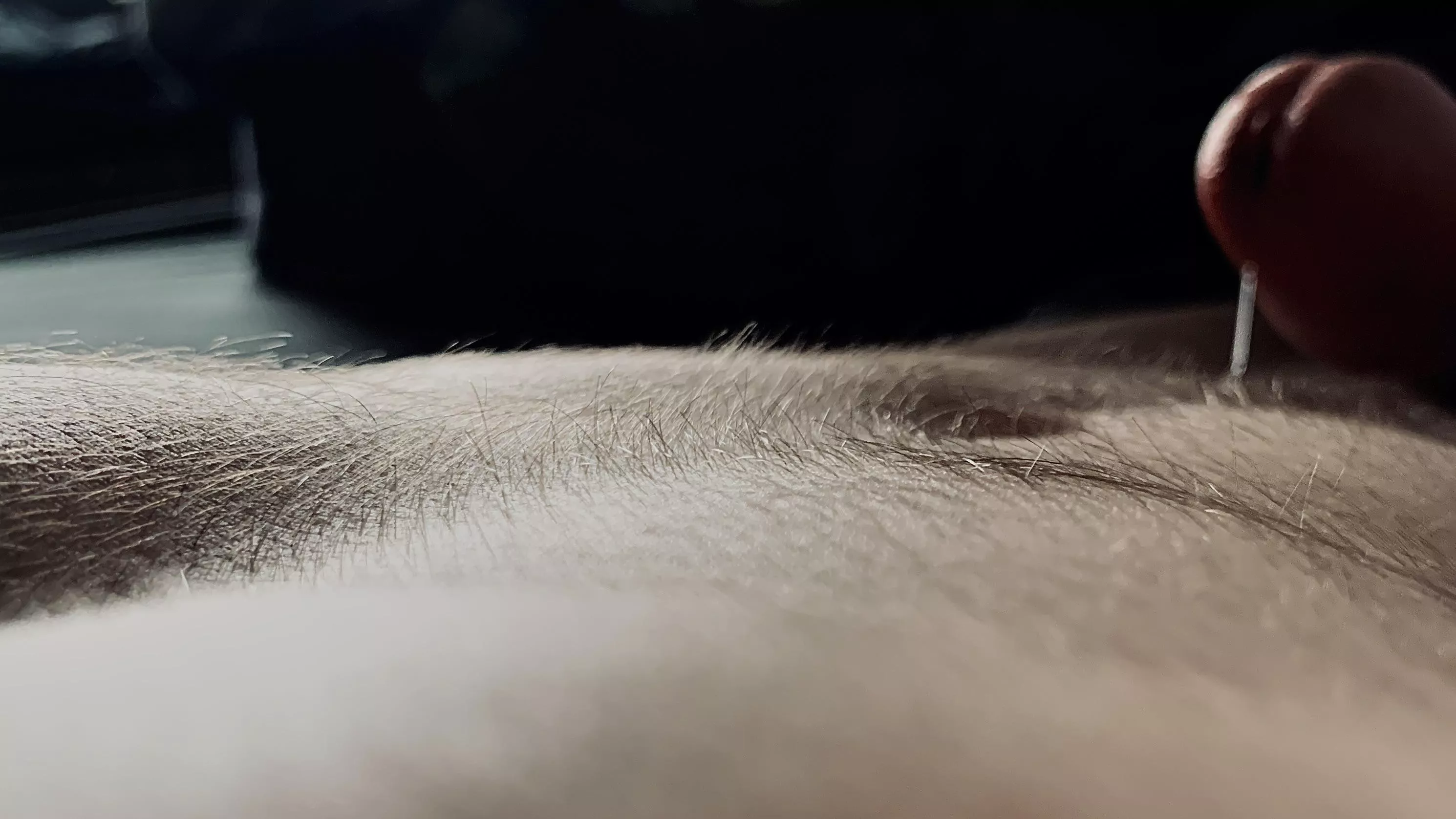 abdominal