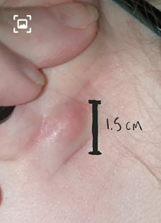 absolute beast behind my ear (OC). will keep you all updated when it pops
