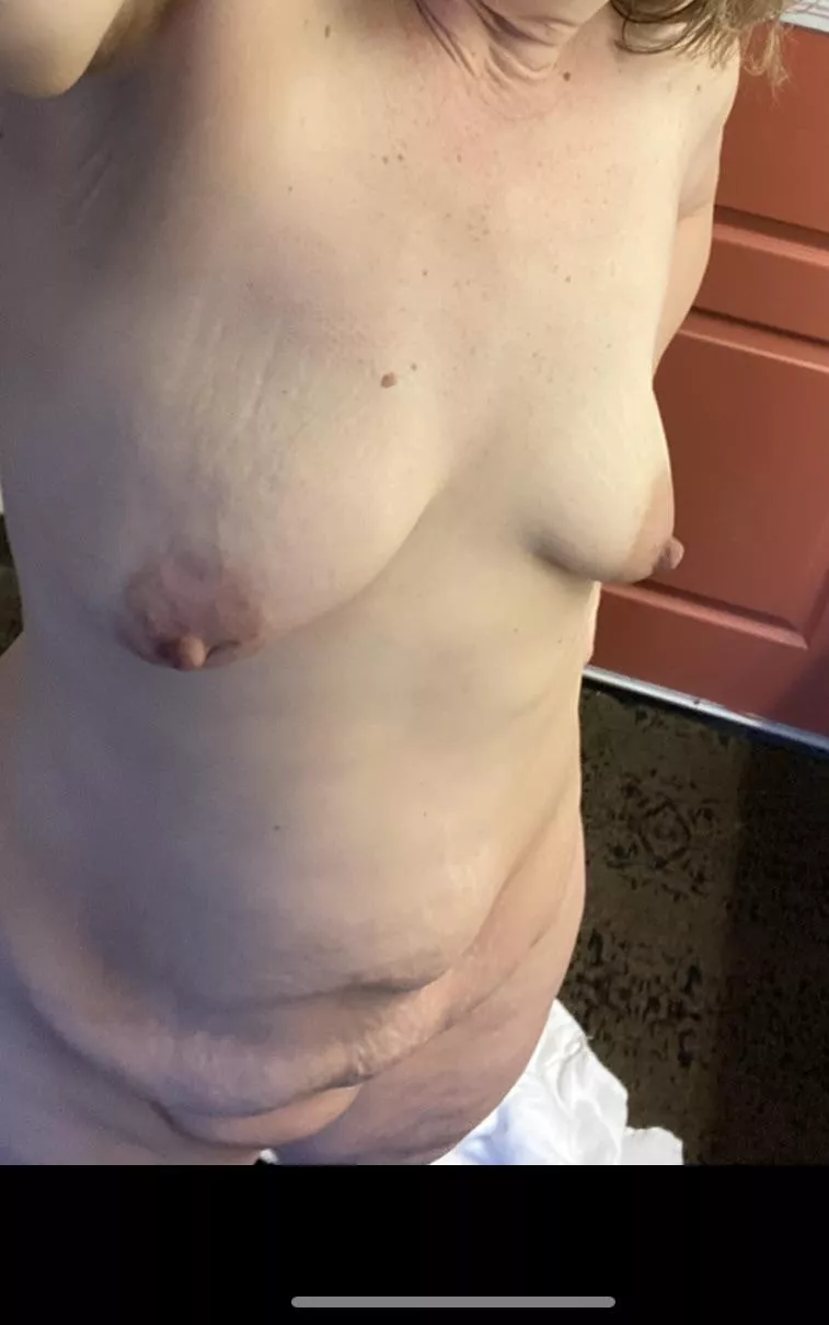 All showered up! Now I could use a hand putting lotion on
