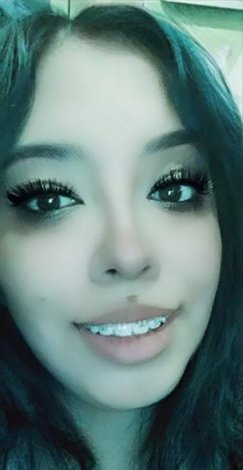 almost 2 years in braces loving my smile 😃 (F, over 18) non NSFW