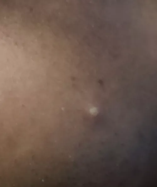 Any day now. I've been avoiding picking at it all week, but I know she's ready to burst.