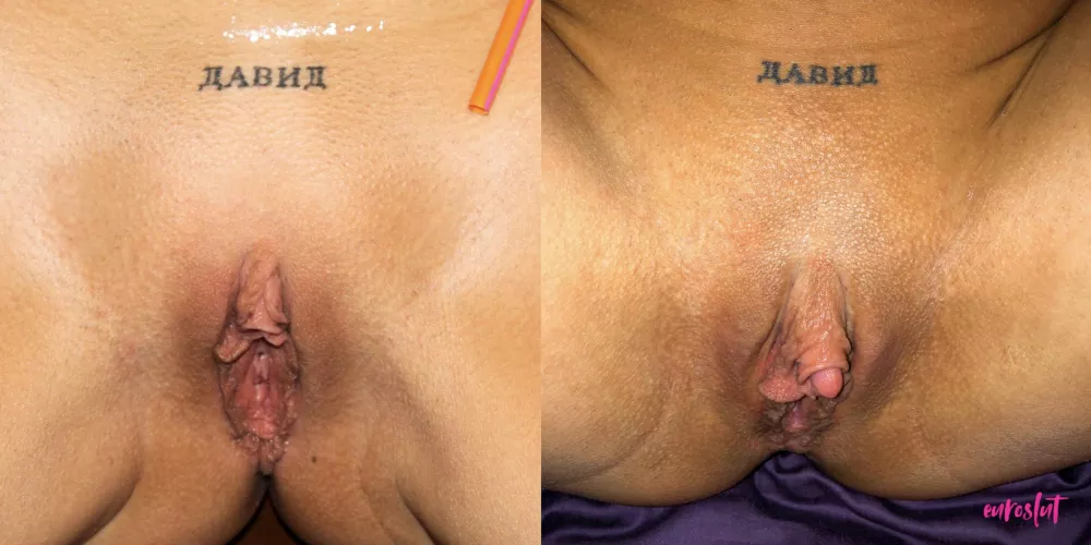 Before & after my big clit enlargement 😳 it’s still amazing to me how big I’ve managed to make my clitoris 😈