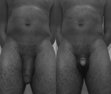 before and after