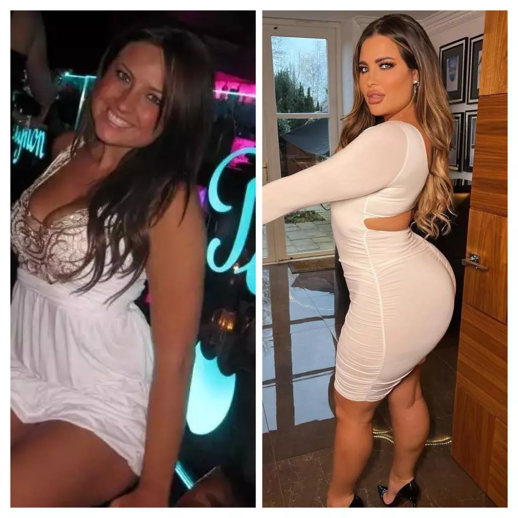 Before and after