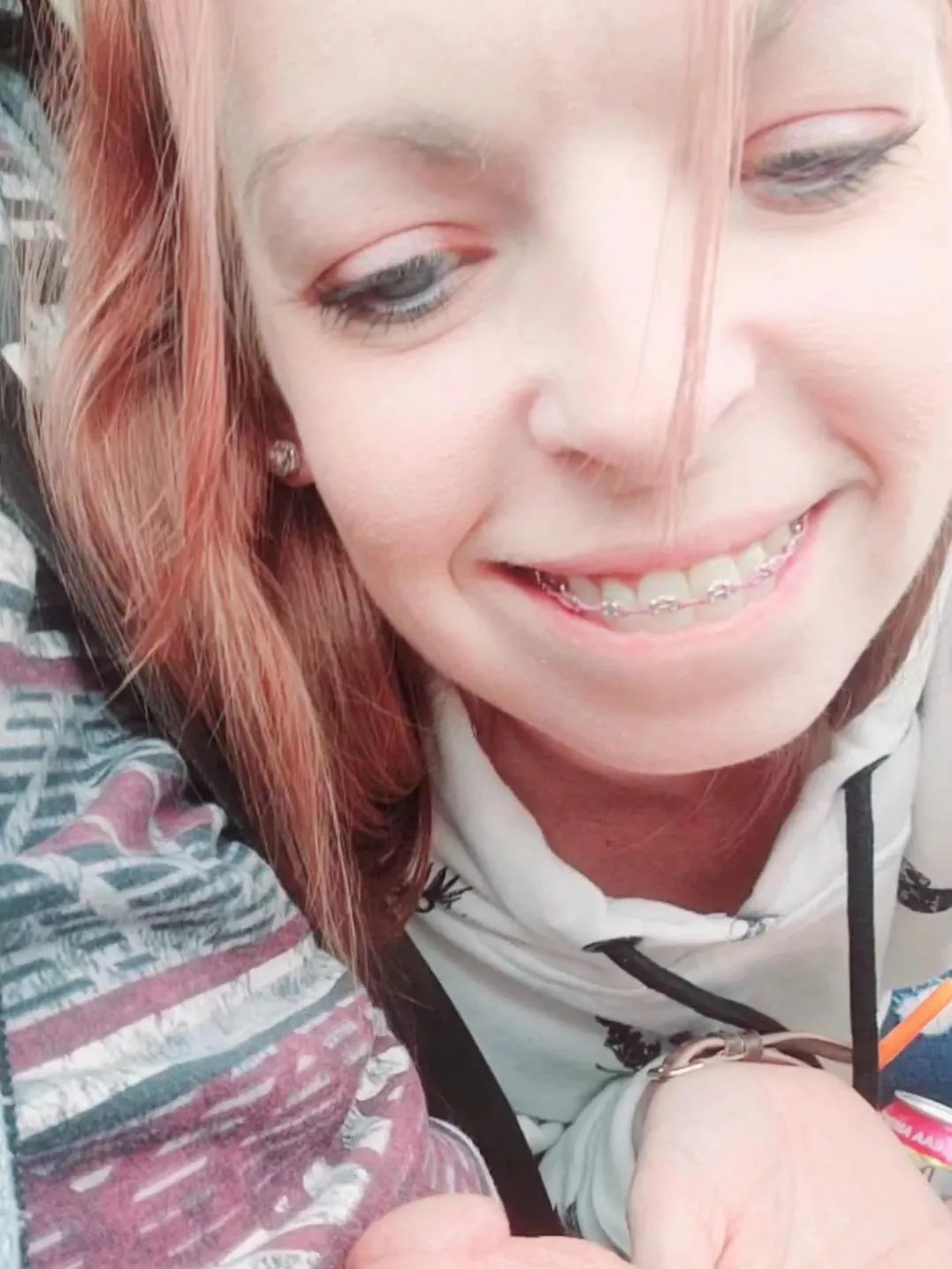 Blue Eyes, Braces, and Blowjobs