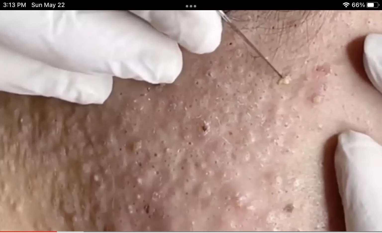 Can anyone source this video? The content is epic, but the link I have is totally stolen! I am afraid to post it here and break any rules… No glove markings, uses a scalpel. I have seen other similar content and would love to find the originals! Can anyone source this video? The content is epic, but the link I have is totally stolen! I am afraid to post it here and break any rules… No glove markings, uses a scalpel. I have seen other similar content and would love to find the originals!