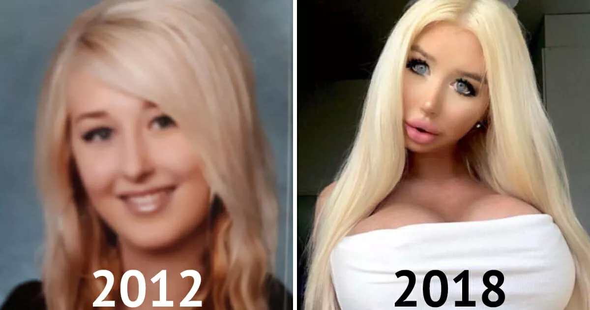 Changes