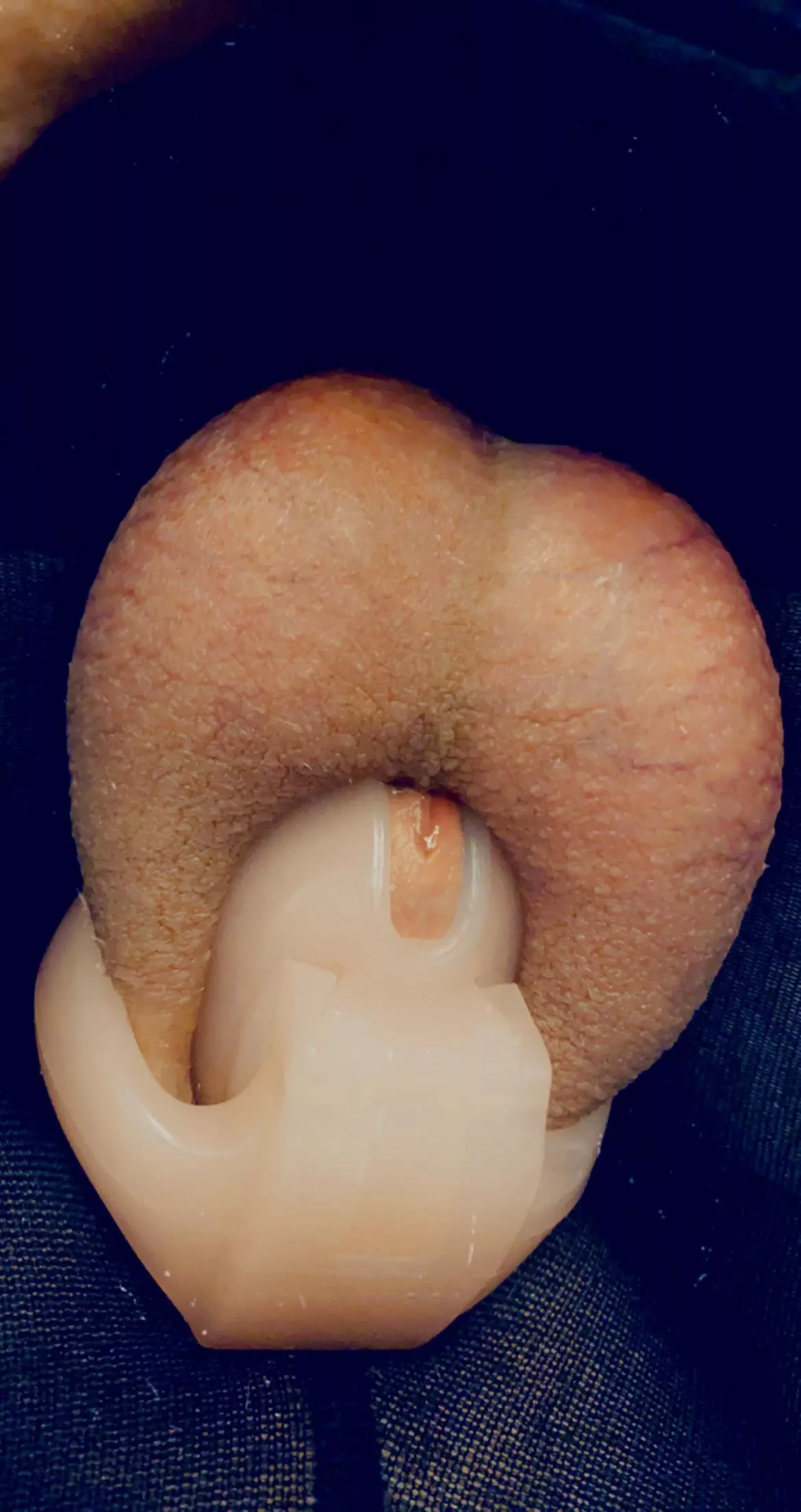 #closeup