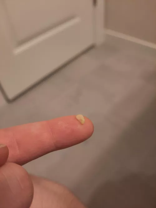 coughed up this guy while laying down.. almost went down my throat