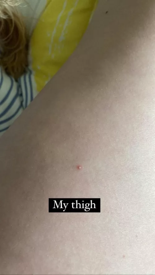 Do I pop it or leave it?