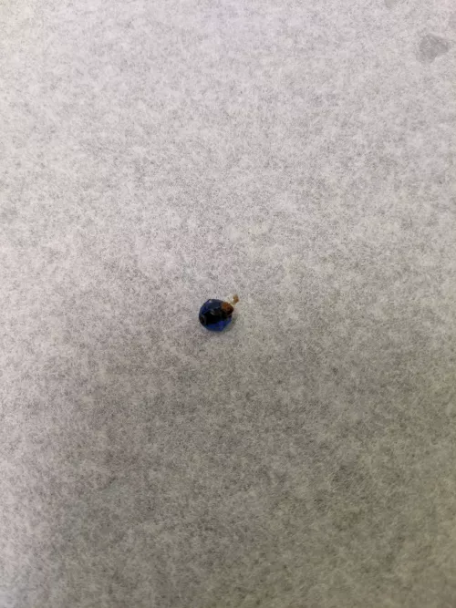 Doc flushed this bead out of my ear that I remember sticking in there when I was a kid. I'm 32 now...