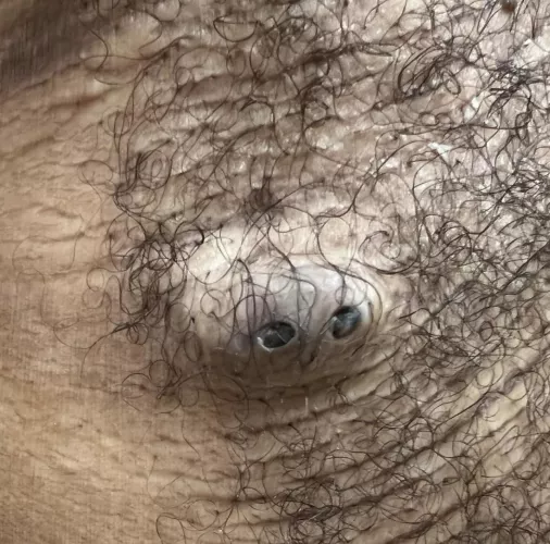 DPOW picture from Dr Sandra Lee on Instagram