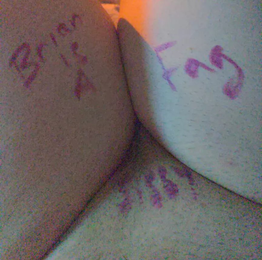expose me