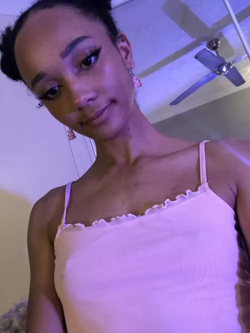 (F21) Mosquito bites 😭😳