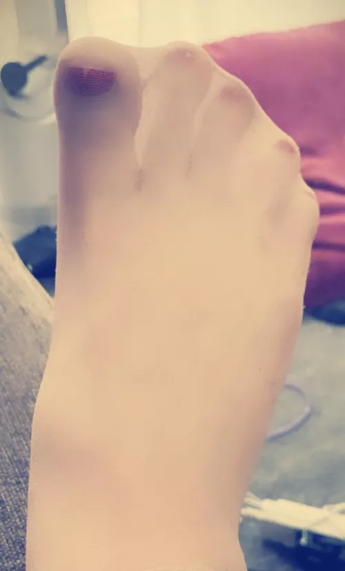 Fighting to break free 😈