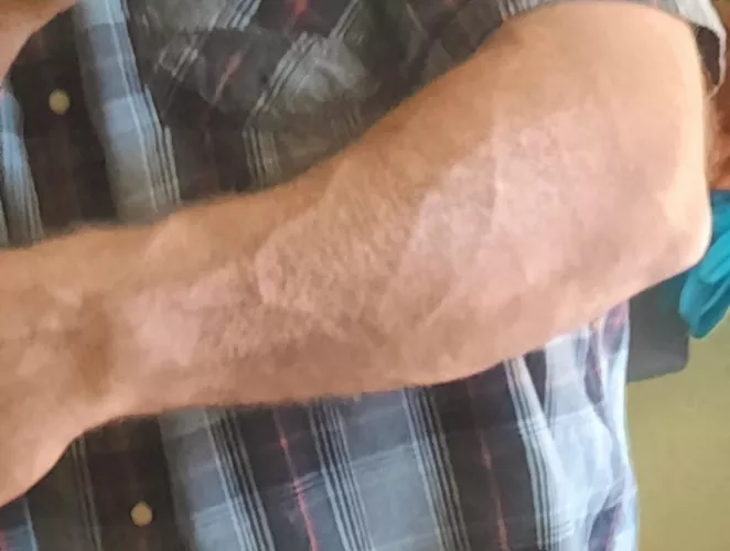 For reference my wrist is 8.25