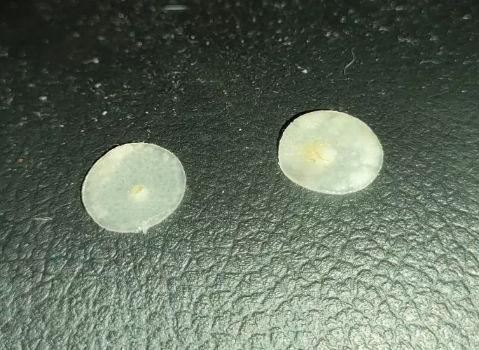 Forgot about my pimple patch for 8 hours, here's what it zapped up