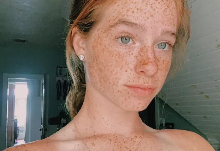 Freckled ginger