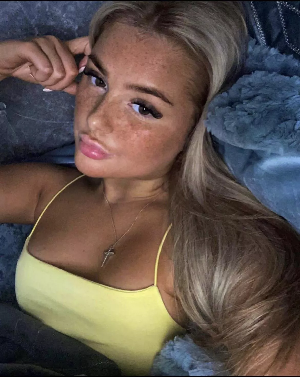 Freckles