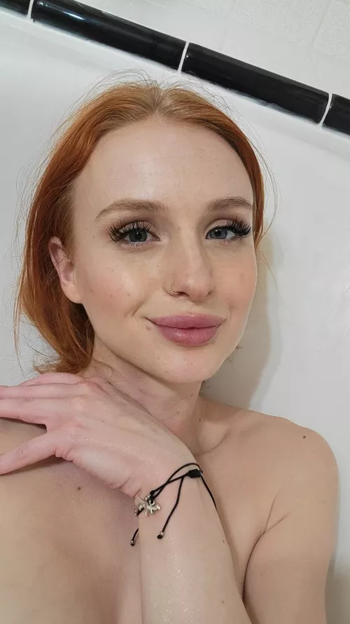 freckles>everything else