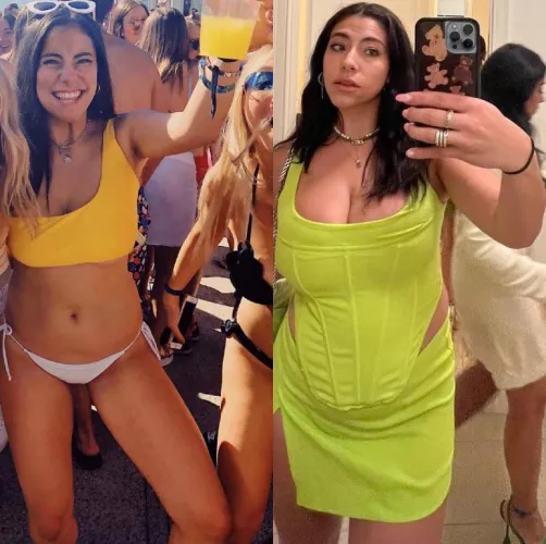 Girl develops watermelons in 4 years