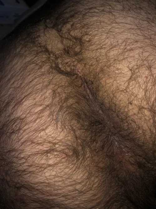 Hairy enough?