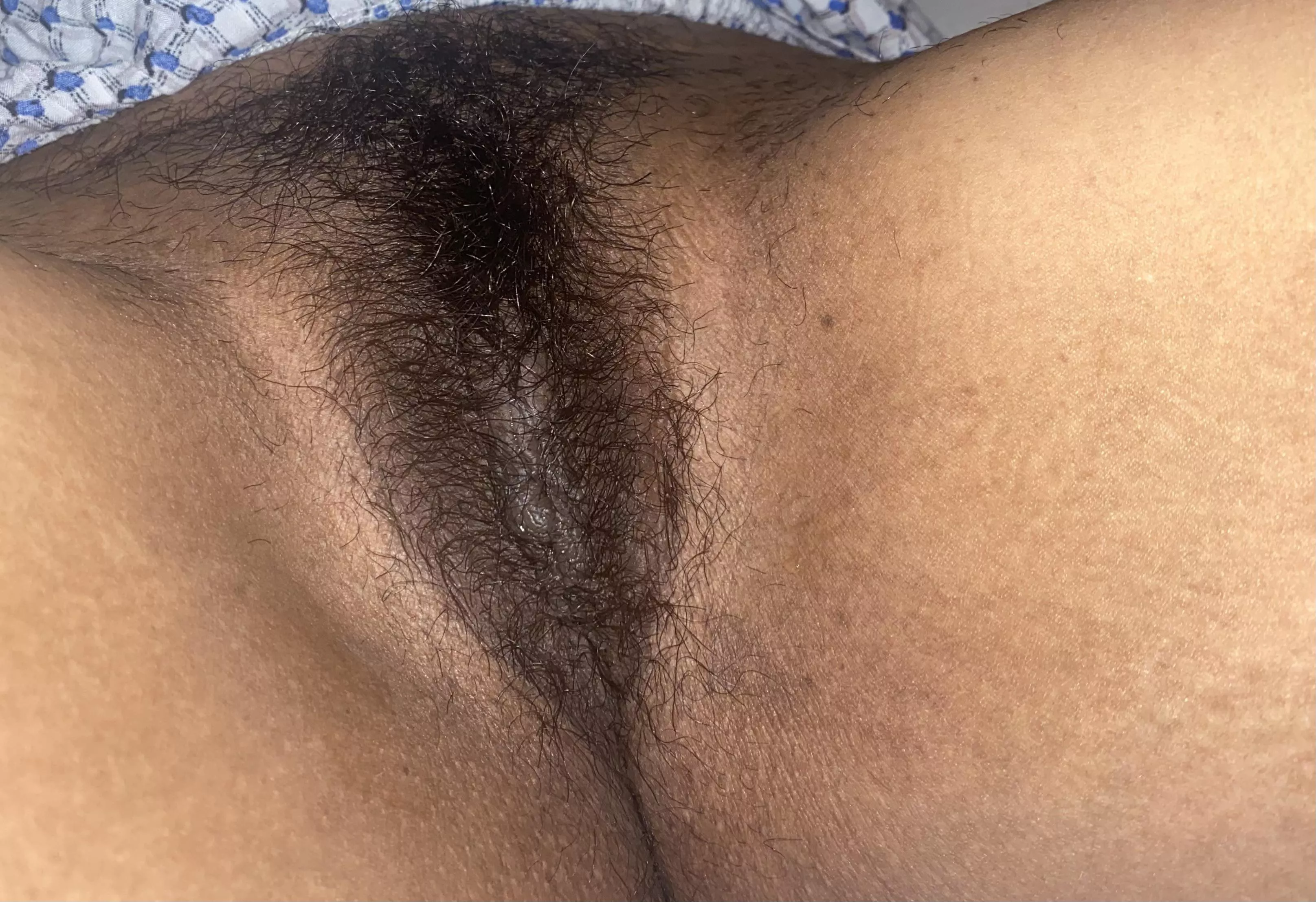 Hairy flash