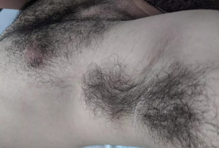 here's a close up of what used to be my hairy pits!