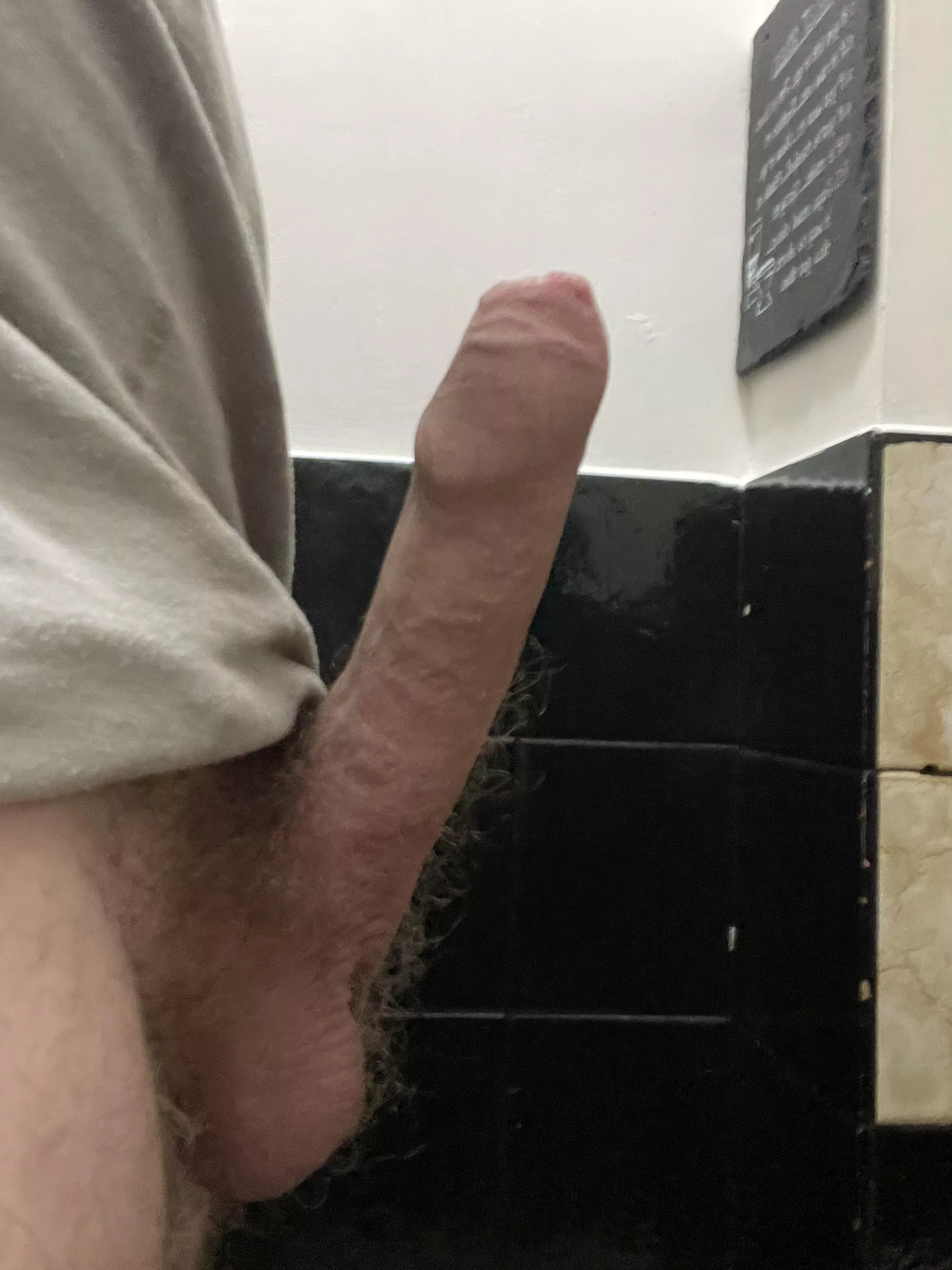 Hi, not sure if this is the right place, but want opinions, and to know who else’s penis goes up this far, issues, good bad? Hi, not sure if this is the right place, but want opinions, and to know who else’s penis goes up this far, issues, good bad?